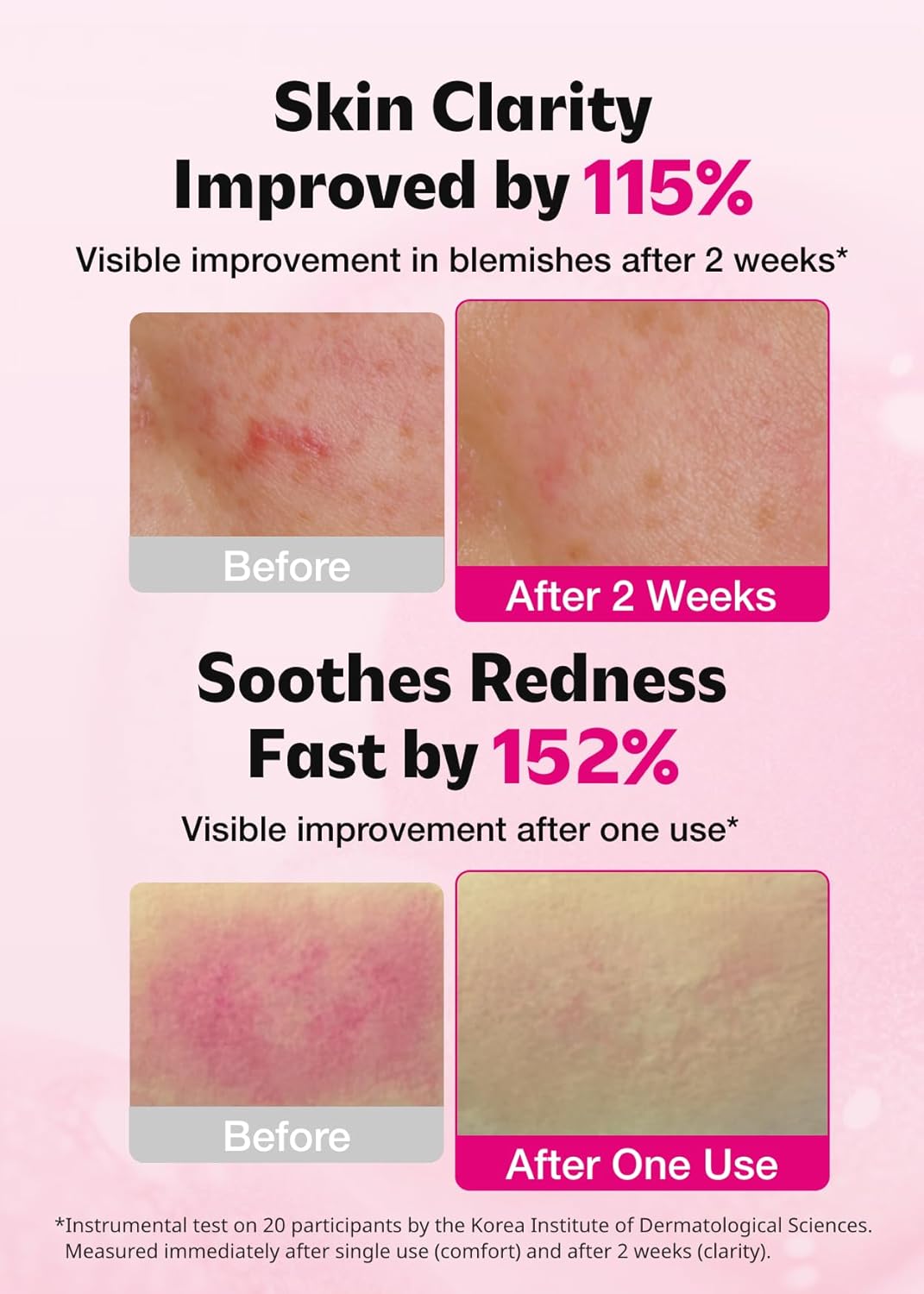 Isoi Blemish Care Up Serum (35mL)