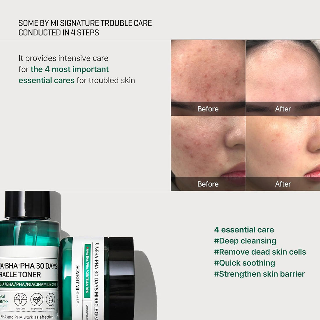 Some By Mi AHA BHA PHA 30 Days Miracle Kit